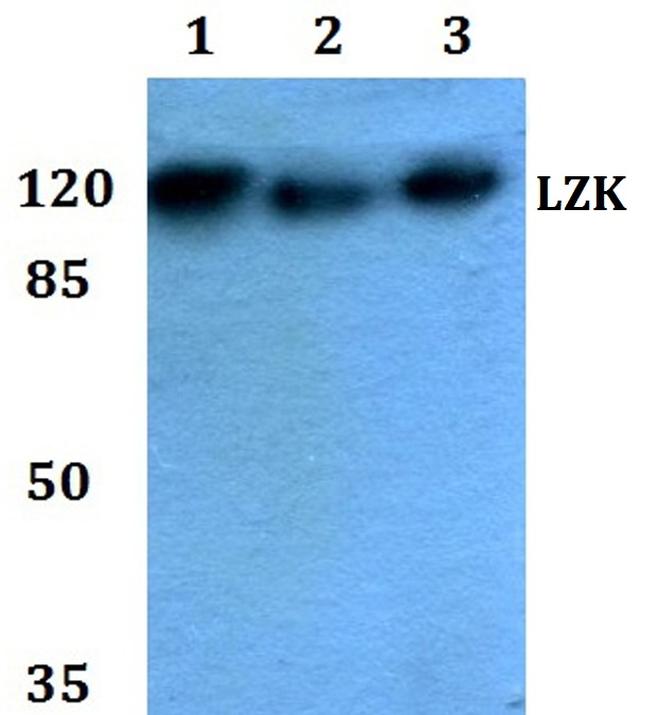 LZK Antibody in Western Blot (WB)