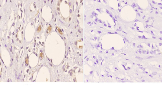 TOP3B Antibody in Immunohistochemistry (Paraffin) (IHC (P))