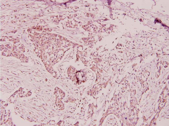 PTX3 Antibody in Immunohistochemistry (Paraffin) (IHC (P))