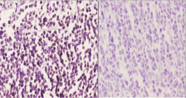 MEK6 Antibody in Immunohistochemistry (Paraffin) (IHC (P))