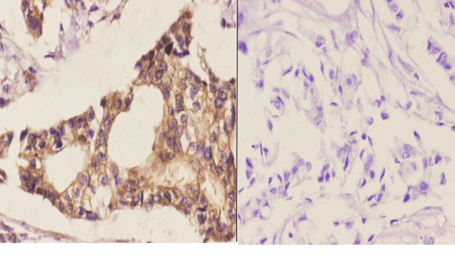 MEK6 Antibody in Immunohistochemistry (Paraffin) (IHC (P))