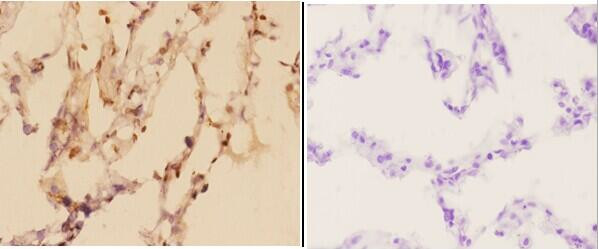 ADARB1 Antibody in Immunohistochemistry (Paraffin) (IHC (P))