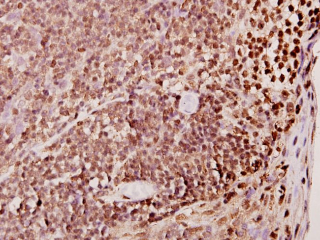 TDE1 Antibody in Immunohistochemistry (Paraffin) (IHC (P))