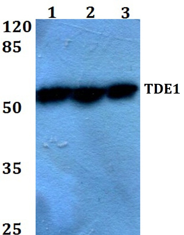 TDE1 Antibody in Western Blot (WB)