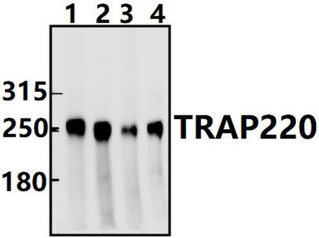 TRAP220 Antibody in Western Blot (WB)