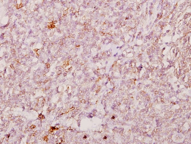 FOXJ1 Antibody in Immunohistochemistry (Paraffin) (IHC (P))