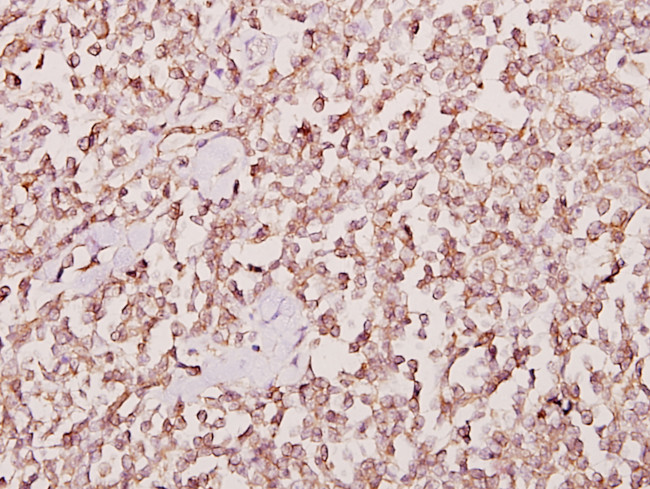 JAKMIP2 Antibody in Immunohistochemistry (Paraffin) (IHC (P))