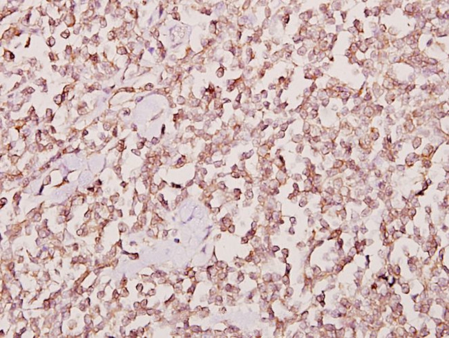 JAKMIP2 Antibody in Immunohistochemistry (Paraffin) (IHC (P))