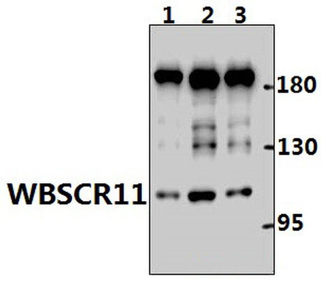 GTF2IRD1 Antibody in Western Blot (WB)