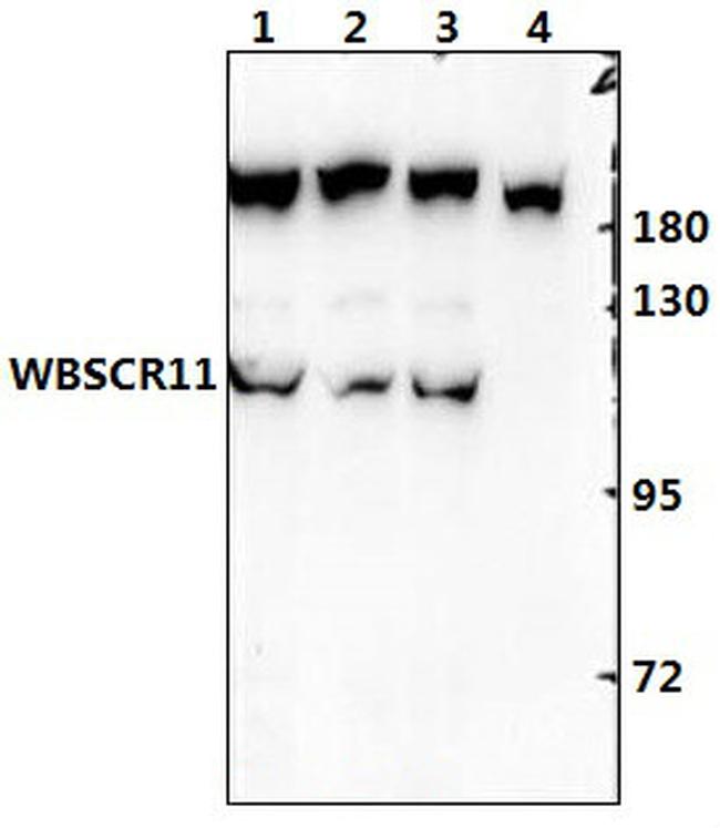 GTF2IRD1 Antibody in Western Blot (WB)