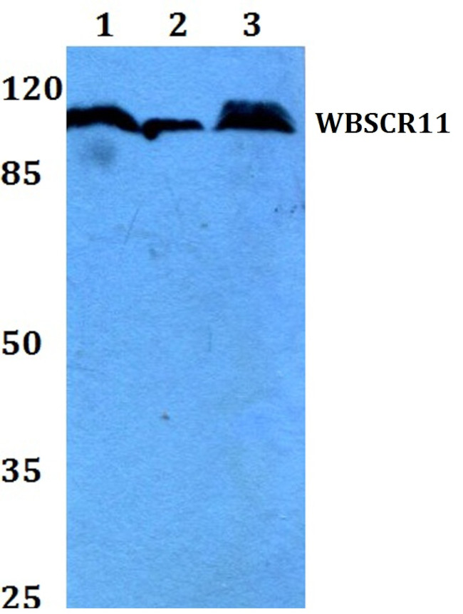 GTF2IRD1 Antibody in Western Blot (WB)