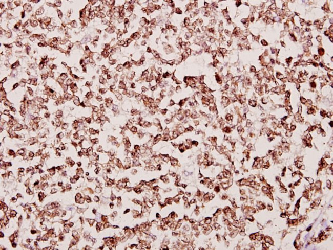 TAF6L Antibody in Immunohistochemistry (Paraffin) (IHC (P))