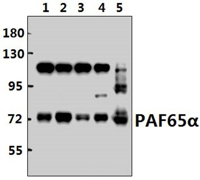 TAF6L Antibody in Western Blot (WB)