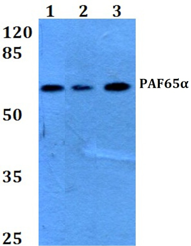 TAF6L Antibody in Western Blot (WB)