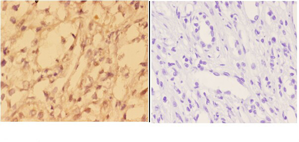 alpha Actinin 3 Antibody in Immunohistochemistry (Paraffin) (IHC (P))