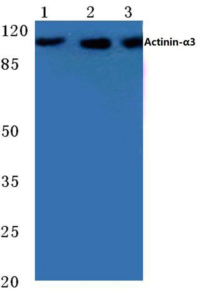 alpha Actinin 3 Antibody in Western Blot (WB)