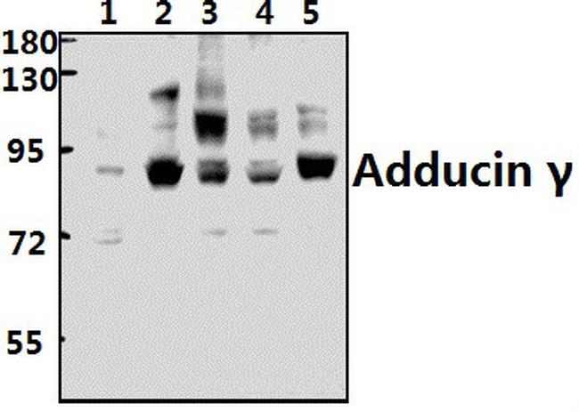 gamma Adducin Antibody in Western Blot (WB)