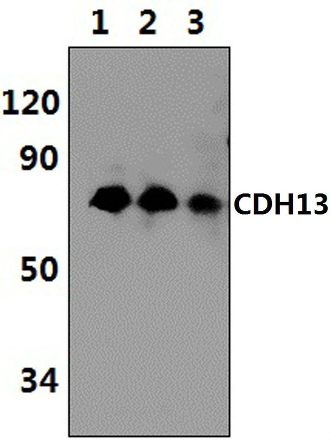 H-cadherin Antibody in Western Blot (WB)