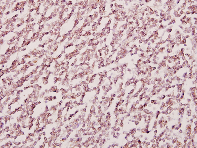 H-cadherin Antibody in Immunohistochemistry (Paraffin) (IHC (P))