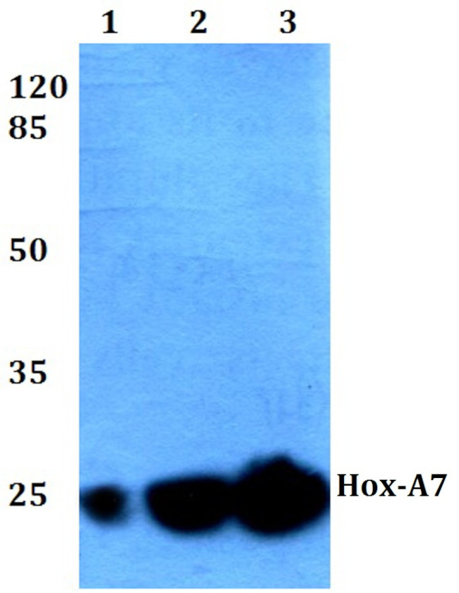 HOXA7 Antibody in Western Blot (WB)