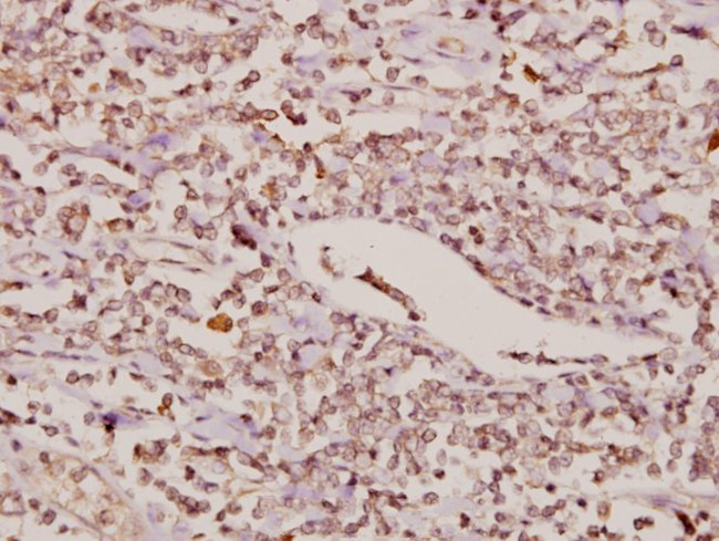 FOXC1/FOXC2 Antibody in Immunohistochemistry (Paraffin) (IHC (P))