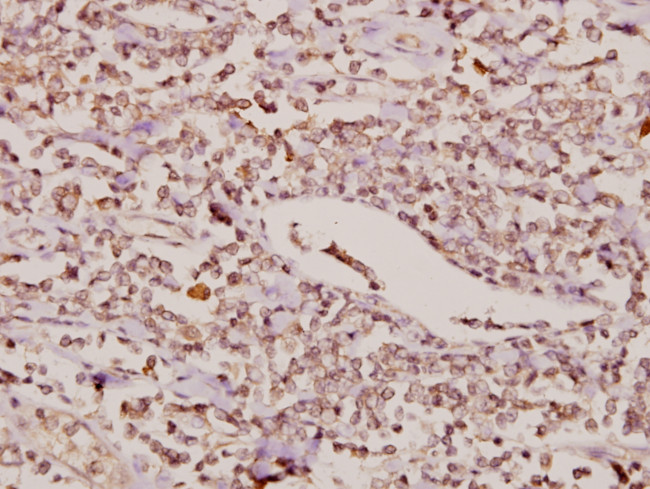 FOXC1/FOXC2 Antibody in Immunohistochemistry (Paraffin) (IHC (P))