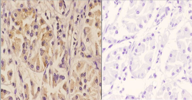 SIAH1/SIAH2 Antibody in Immunohistochemistry (Paraffin) (IHC (P))