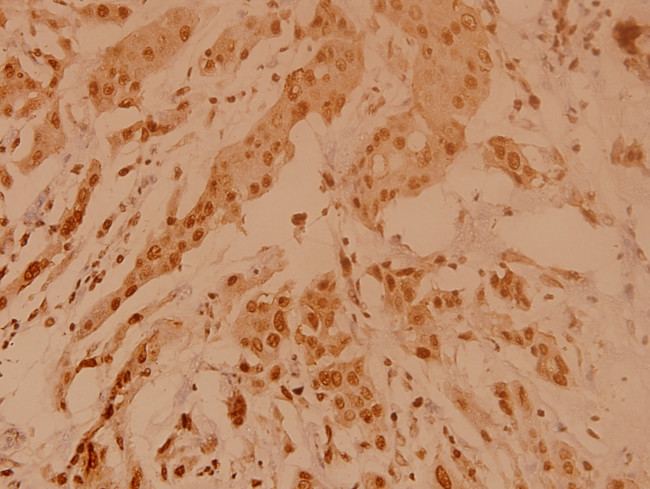 NPM1 Antibody in Immunohistochemistry (Paraffin) (IHC (P))