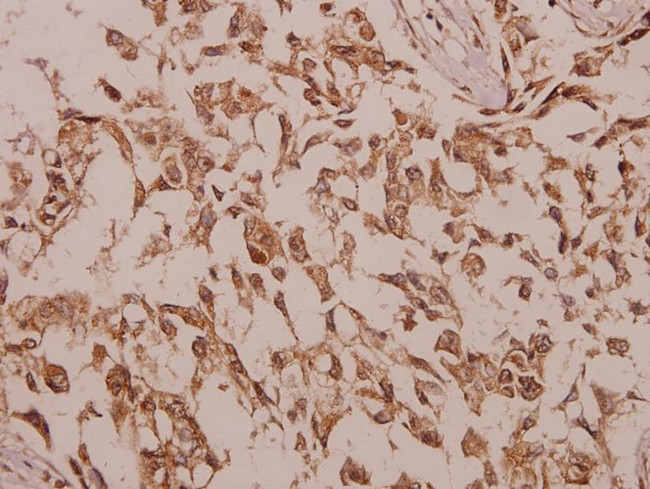 CHKB Antibody in Immunohistochemistry (Paraffin) (IHC (P))