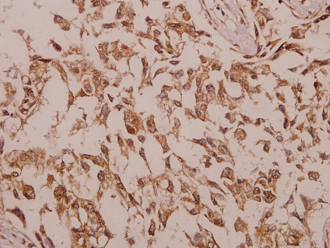 CHKB Antibody in Immunohistochemistry (Paraffin) (IHC (P))