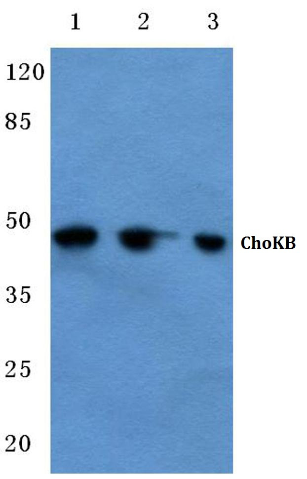 CHKB Antibody in Western Blot (WB)