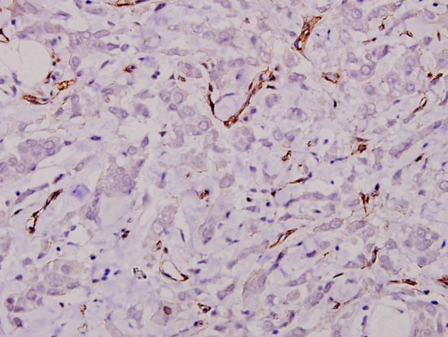 Laminin gamma-1 Antibody in Immunohistochemistry (Paraffin) (IHC (P))