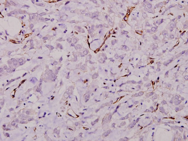 Laminin gamma-1 Antibody in Immunohistochemistry (Paraffin) (IHC (P))