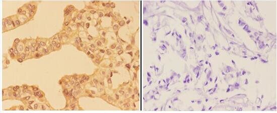 AMPK gamma-1,2,3 Antibody in Immunohistochemistry (Paraffin) (IHC (P))