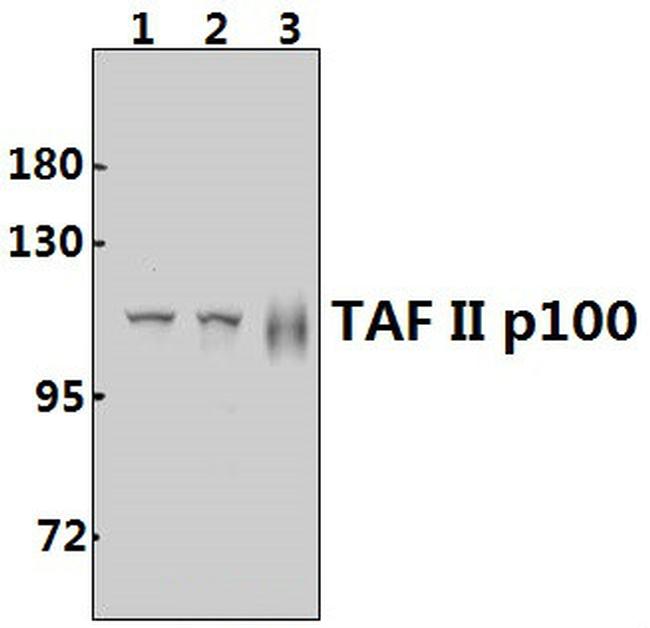 TAF5 Antibody in Western Blot (WB)