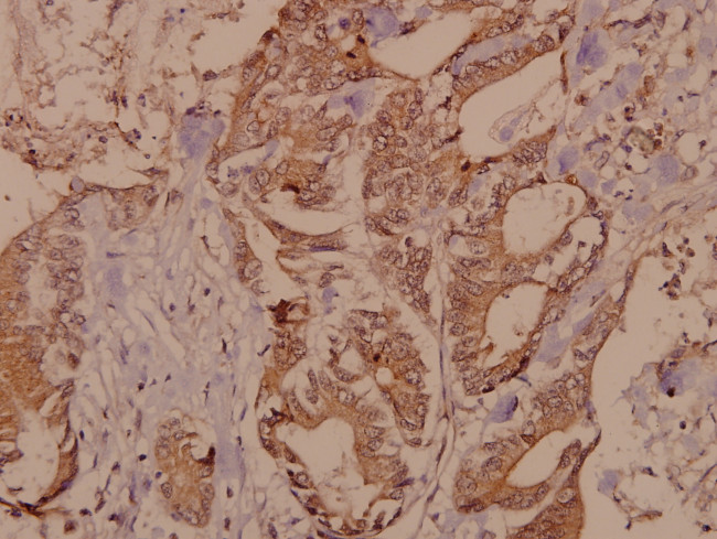 RSK4 Antibody in Immunohistochemistry (Paraffin) (IHC (P))