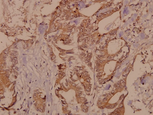 RSK4 Antibody in Immunohistochemistry (Paraffin) (IHC (P))