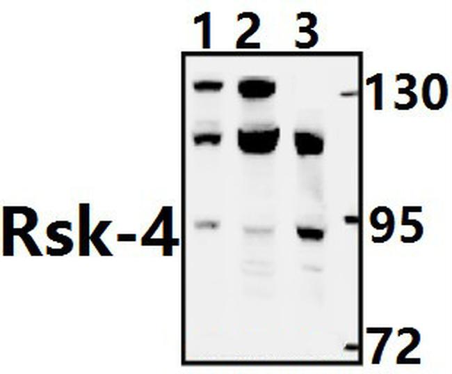 RSK4 Antibody in Western Blot (WB)