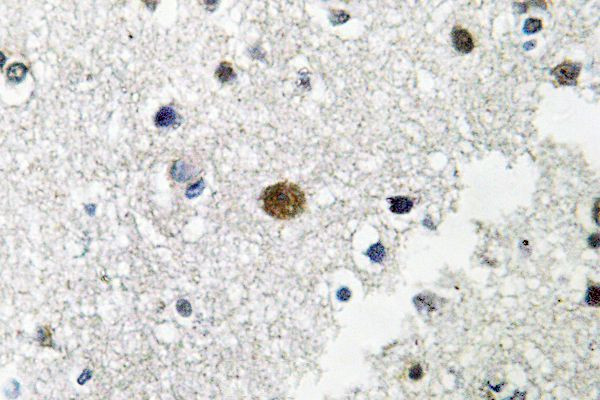 BRF1 Antibody in Immunohistochemistry (Paraffin) (IHC (P))