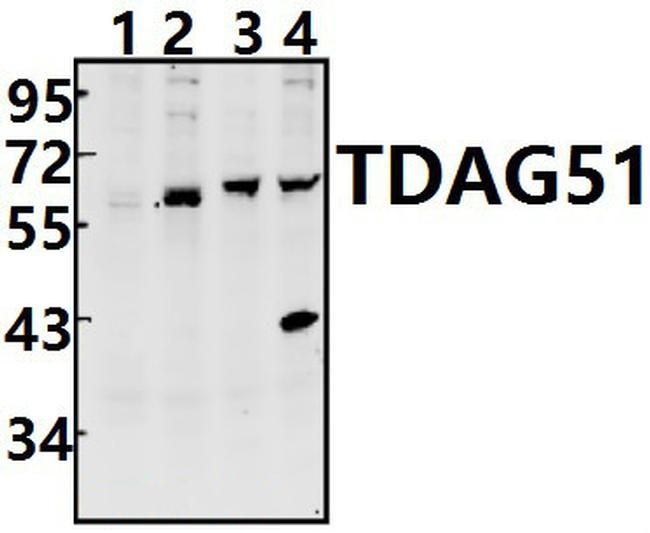 PHLDA1 Antibody in Western Blot (WB)