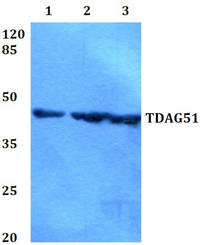 PHLDA1 Antibody in Western Blot (WB)