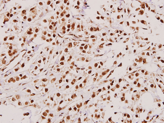 TACC3 Antibody in Immunohistochemistry (Paraffin) (IHC (P))