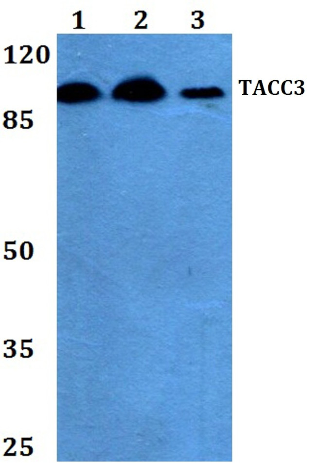 TACC3 Antibody in Western Blot (WB)