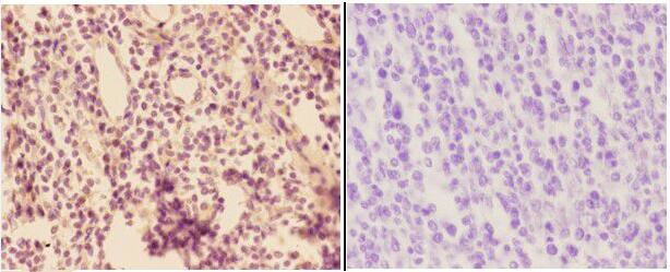 ADORA3 Antibody in Immunohistochemistry (Paraffin) (IHC (P))