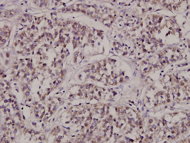 CTPS Antibody in Immunohistochemistry (Paraffin) (IHC (P))