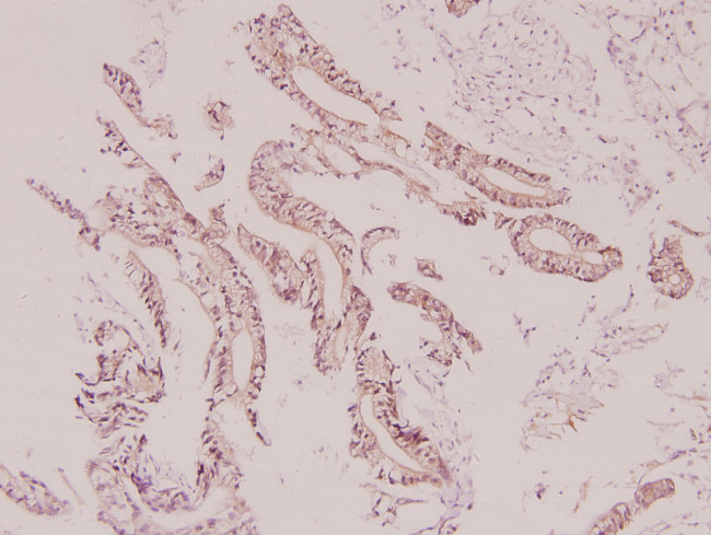 UCP2 Antibody in Immunohistochemistry (Paraffin) (IHC (P))