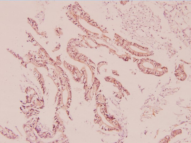 UCP2 Antibody in Immunohistochemistry (Paraffin) (IHC (P))