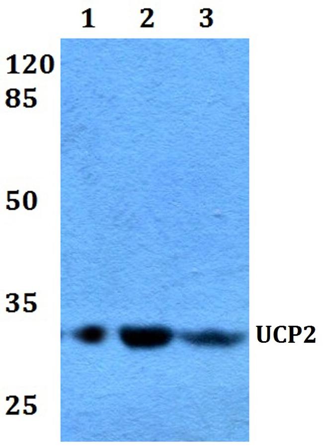 UCP2 Antibody in Western Blot (WB)