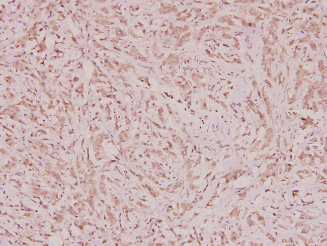 NCOA4 Antibody in Immunohistochemistry (Paraffin) (IHC (P))