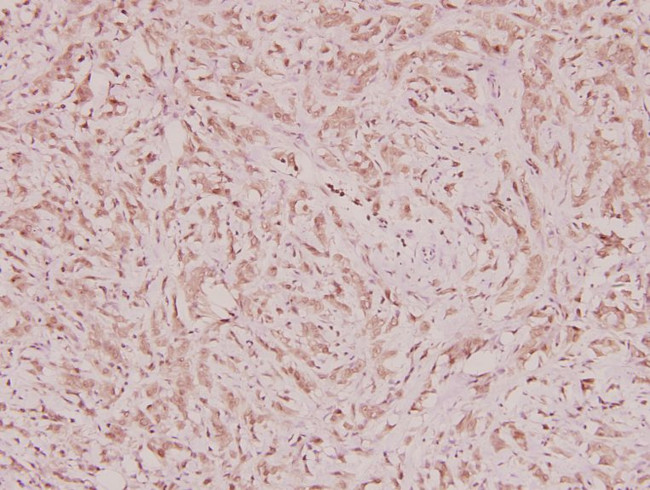 NCOA4 Antibody in Immunohistochemistry (Paraffin) (IHC (P))